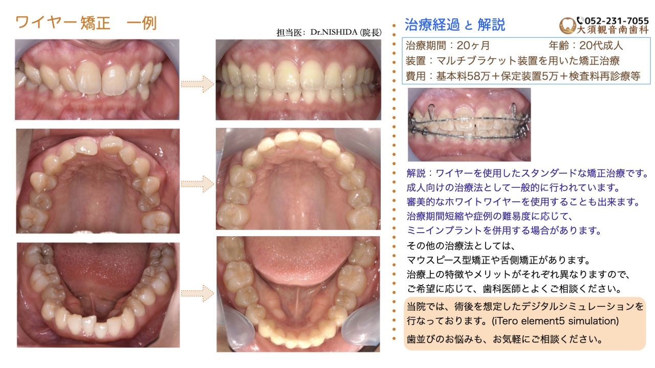 case1