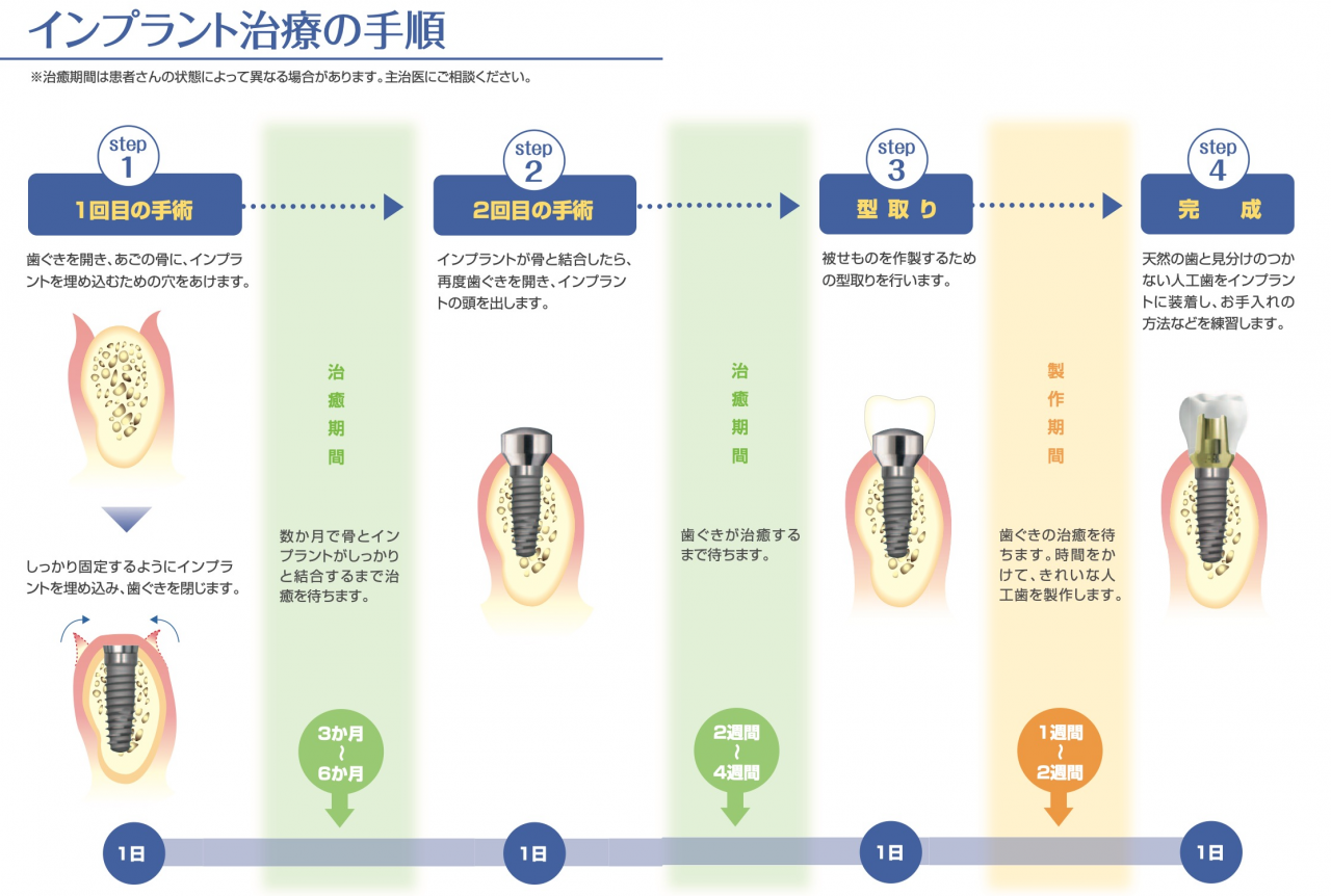 インプラント６