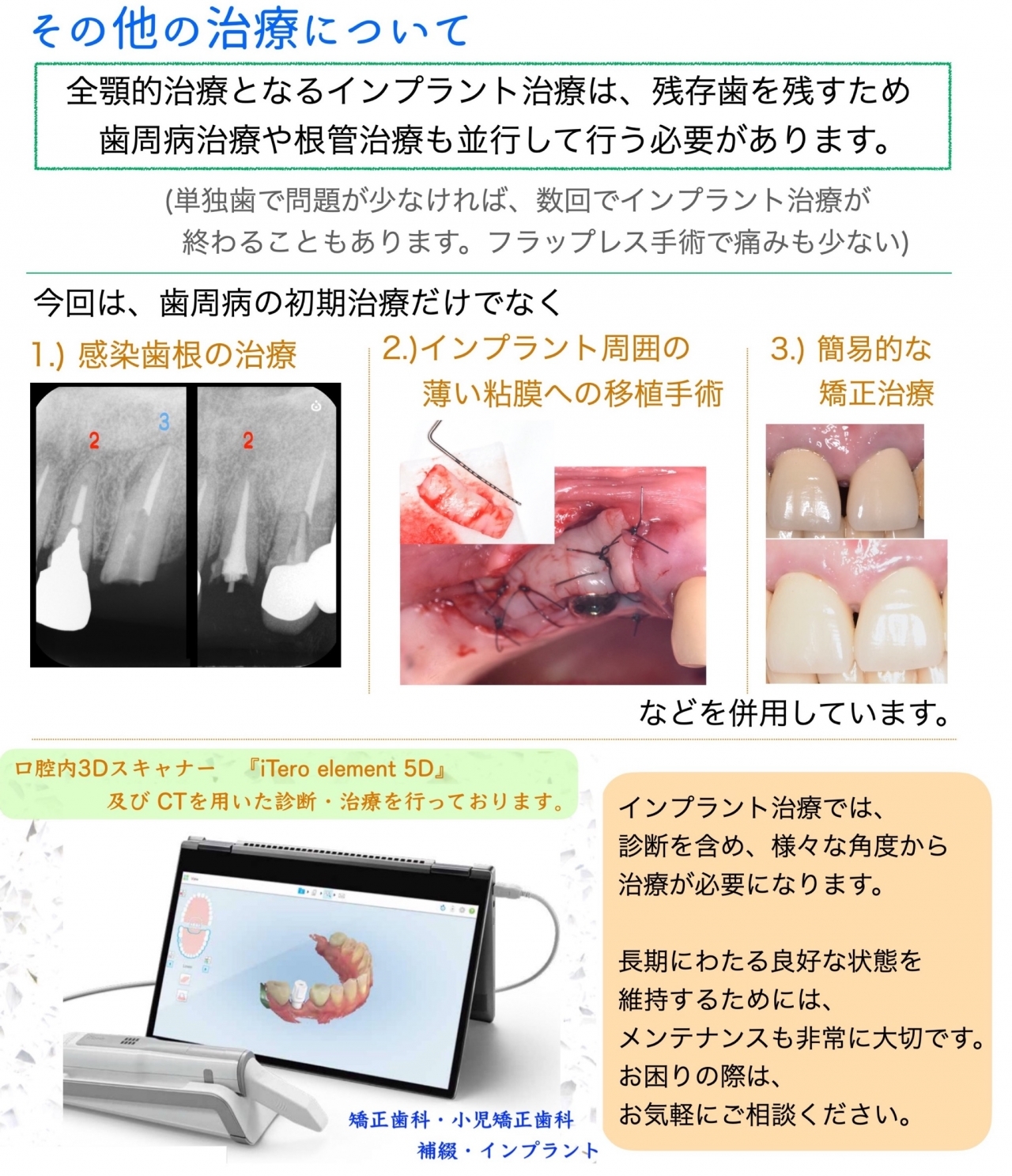 インプラント | 大須観音南歯科