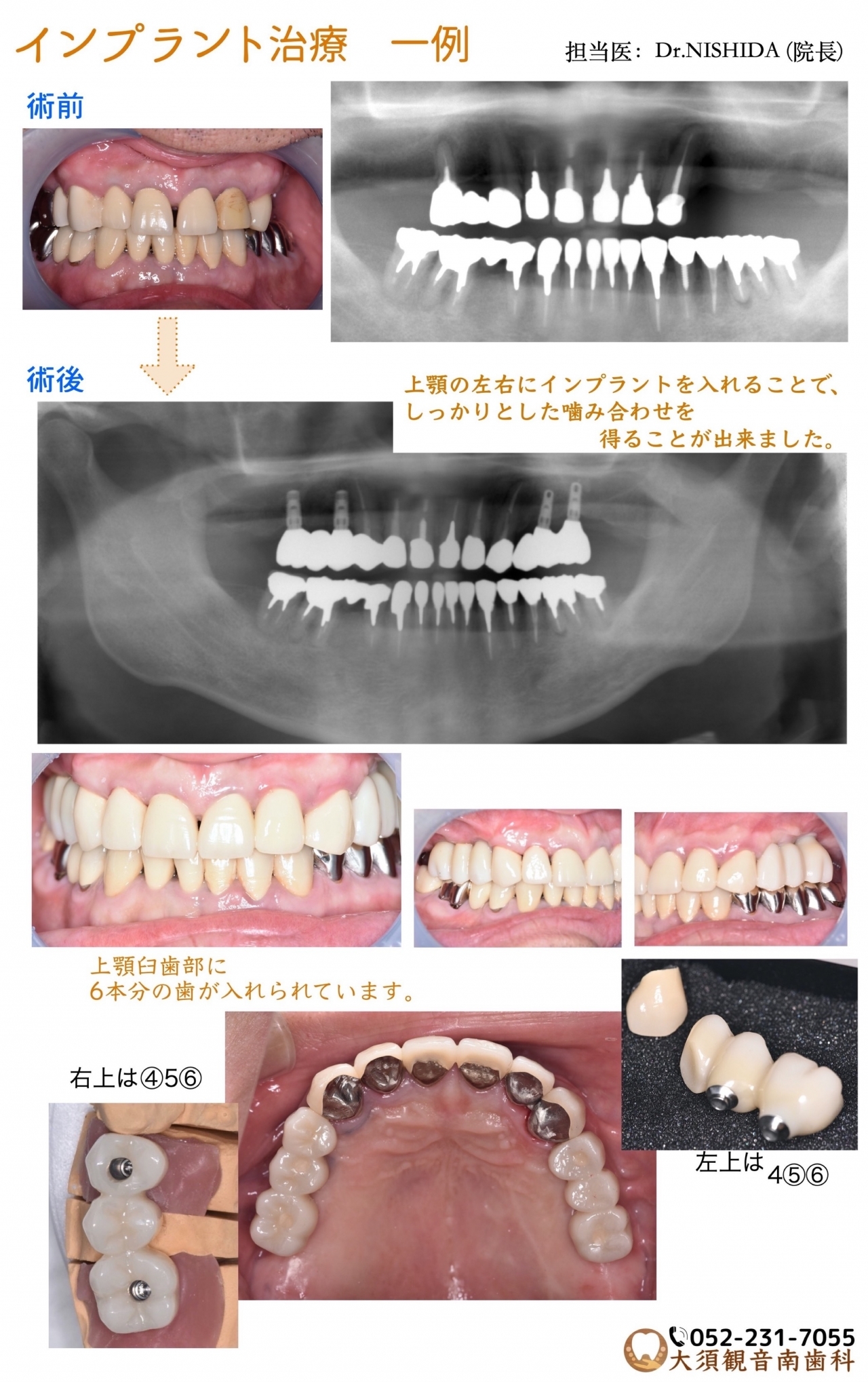 102症例で知るインプラント日常臨床 - クインテッセンス出版