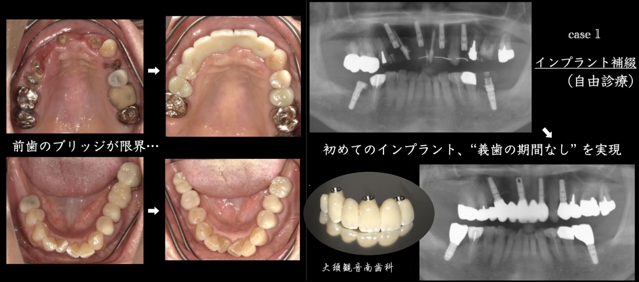 case1